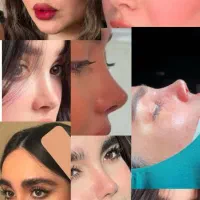 جشنواره پاییزه عمل بینی فقط 40 میلیون هزینه کل