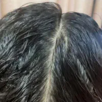 شپش بانوان پاکسازی میکنم در یک جلسه.  تضمینی.|خدمات آرایشگری و زیبایی|اردبیل, |دیوار