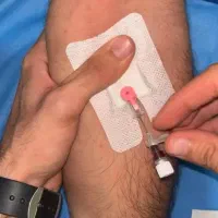 خدمات پرستاری درمنزل   شبانه روزی