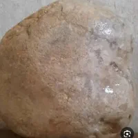 سنگ درمان