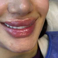 مطب پوست ولیزر دکتر راستگو|خدمات آرایشگری و زیبایی|تهران, مهرآباد|دیوار