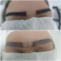 کلینیک مجوزدار کاشت ابرو در قم|خدمات آرایشگری و زیبایی|قم, ارم|دیوار