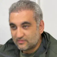 کاشت مو ابرو