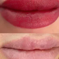 تخفیف ویژه میکروبلیدینگ|خدمات زیبایی و سلامت|رشت, معلم|دیوار