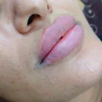 خدمات ژل و بوتاکس|خدمات آرایشگری و زیبایی|بهبهان, |دیوار