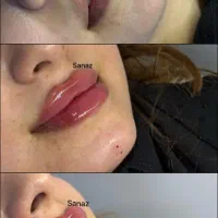 تخفیف ویژه ژل وبوتاکس|خدمات آرایشگری و زیبایی|ایذه, |دیوار