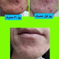 طب سنتی،درمانی اصولی وقطعی