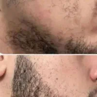 ریشاتو بفرست باشگاه وقت حجیم شدنه
