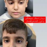 مرکز تخصصی لیزر موهای زائد الکس پلاس شاتی(هوشمند)|خدمات آرایشگری و زیبایی|رشت, گلسار|دیوار