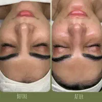 تخفیفات ویژه فیشال کره ای در سه جلسه خانم وآقا