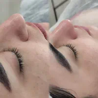 80هزارتومن اصلاح صورت بانوان