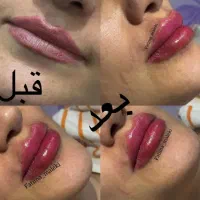 آفر ویژه آموزش حرفه ای فیلر و بوتاکس تا آخر هفته|خدمات آموزشی|تهران, هفت حوض|دیوار