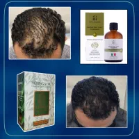 ریزش موهات برای همیشه قطع میشه