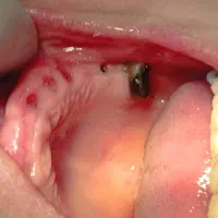 خدمات تخصصی دندانپزشکی تضمینی و اقساطی|خدمات آرایشگری و زیبایی|نیشابور, دارایی|دیوار