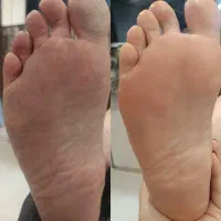 پدیکور پا در تحفیف ویژه