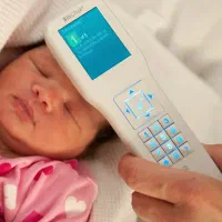 تست یا آزمایش زردی نوزاد (( بدون خونگیری ))
