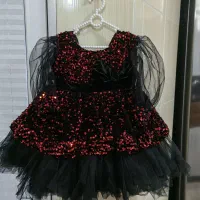 پیراهن عروسکی|لباس|علیآباد کتول, |دیوار