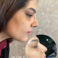 عمل بینی مدت اف محدوده