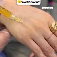 جشنواره خدمات ژل فقط 550و بوتاکس750|خدمات آرایشگری و زیبایی|فولادشهر, C3|دیوار