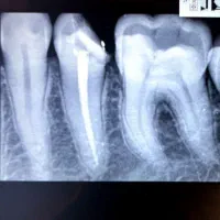 خدمات دندانپزشکی با قیمت مناسب|خدمات آرایشگری و زیبایی|تهران, مینابی|دیوار