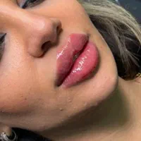 تخفیفات 50% ژل و بوتاکس شروع قیمت از ۳۰۰ت|خدمات آرایشگری و زیبایی|قم, سالاریه|دیوار