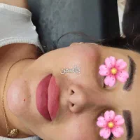 تزریق ژل و بوتاکس و پیرسینگ