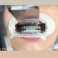 خدمات دندان پزشکی و دندان سازی|خدمات آرایشگری و زیبایی|زنجان, |دیوار