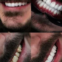 خدمات وآموزش کامپوزیت کاشت موو ابرو ومعرفی به کار