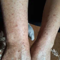 خال برداری|خدمات آرایشگری و زیبایی|دورود, |دیوار