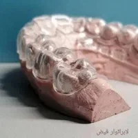 دندان‌سازی. دندان‌مصنوعی. لابراتوار دندانسازی|خدمات آرایشگری و زیبایی|مشهد, ولیعصر (شهرک غرب)|دیوار