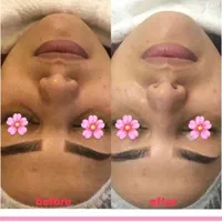 فیشال تخصصی و درمانی قم|خدمات آرایشگری و زیبایی|قم, زنبیل آباد|دیوار