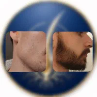 ۱۹ روزه|آرایشی، بهداشتی، درمانی|کرمانشاه, |دیوار