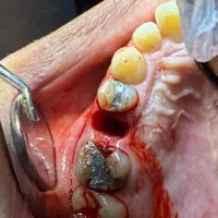 خدمات تخصصی دندانپزشکی تضمینی و اقساطی|خدمات آرایشگری و زیبایی|نیشابور, دارایی|دیوار