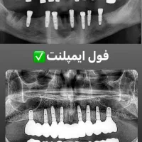 مرکز ایمپلنت شرق|خدمات آرایشگری و زیبایی|تهران, چهارصد دستگاه|دیوار