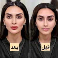 فیلر زل بوتاکس مزو بایو فیس لیفت پر کننده50/|خدمات آرایشگری و زیبایی|مشهد, هفت تیر (حافظ)|دیوار