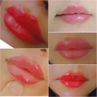 آموزش وارائه خدمات ژل و بوتاکس و فیلربادی(ژل بدن)