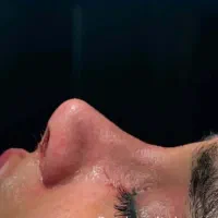 اقساط 24 ماهه جراحی ها فقط با جراحان پلاستیک درجه1|خدمات آرایشگری و زیبایی|تهران, محمودیه|دیوار