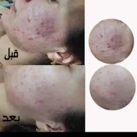 پاکسازی تخصصی