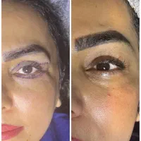 جراحی صورت و بدن(زیبایی و لاغری)