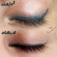از شر تتوی قدیمیت خلاص شو|خدمات آرایشگری و زیبایی|تربت‌حیدریه, فرمانداری|دیوار