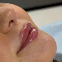 تمامی خدمات ژل ۹۹۰ اف محرم فقط امروز