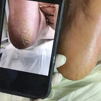 اموزش حرفه پدیکور خشک و خیس