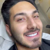 جشنواره کامپوزیت ونیر از فکی ۶ با شرایط اقساط