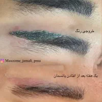 خدمات تخصصی ریمووتتوومیکروپیگمنتیشن ولیفت|خدمات آرایشگری و زیبایی|گنبد کاووس, |دیوار