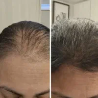 جشنواره ویژه تیرماه محصولات مراقبتی تضمینی