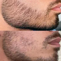 بالاخره پرپشت میشه