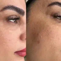 کرم معجزه شب و صابون صندل