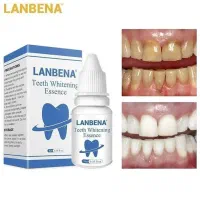سرم سفید کننده دندان مدل LANBENA