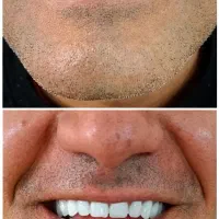 دندان مصنوعی و دندانسازی ، خدمات دندان سازی|خدمات آرایشگری و زیبایی|مشهد, شفا|دیوار