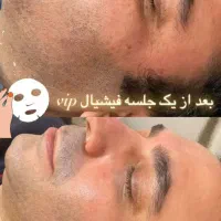 فیشیال صورت آقایان و خانم ها مطب دکترپروین گودرزی|خدمات آرایشگری و زیبایی|یاسوج, |دیوار